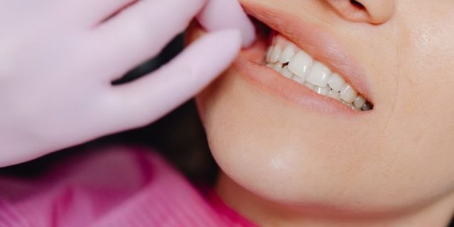 20’lik Diş Çekimi Nedir